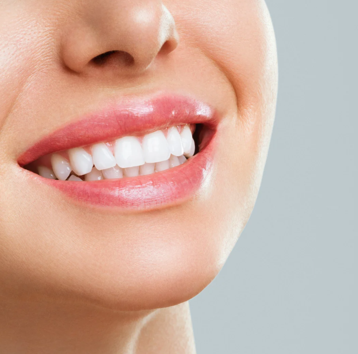 Dental Bonding in Camp Verde, AZ | Fix Chips & Gaps Fast