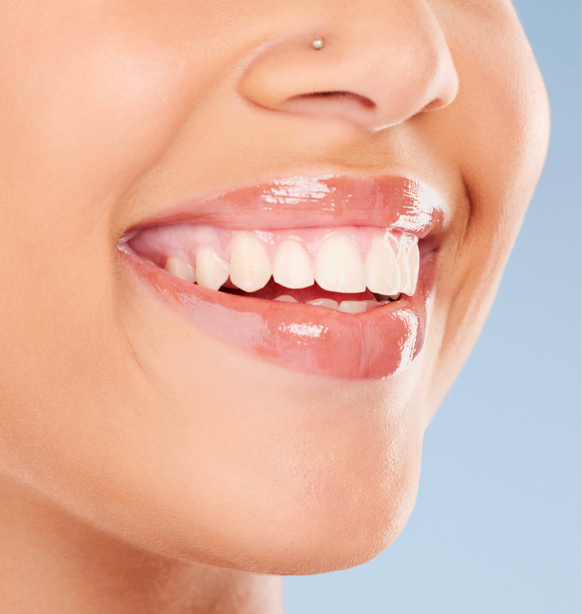 Get the smile of your dreams with Veneers from Verde Smiles!